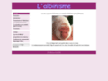 albinisme.free.fr/