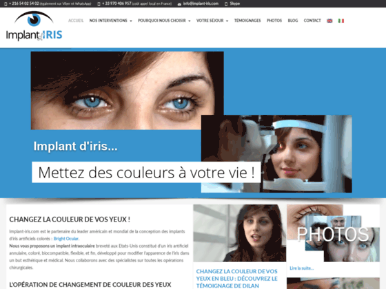 Implant iris en Tunisie : comment changer la couleur de vos yeux !