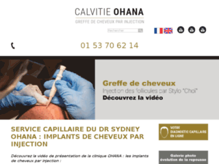 Détails : Chirurgie capillaire à paris, Dr Aziza
